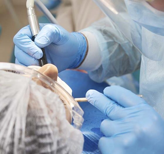 implante tras una extracción dental. Implantes dentales en Avilés