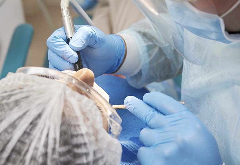 Implante tras una extracción dental. Todas las ventajas Suárez Rivaya.