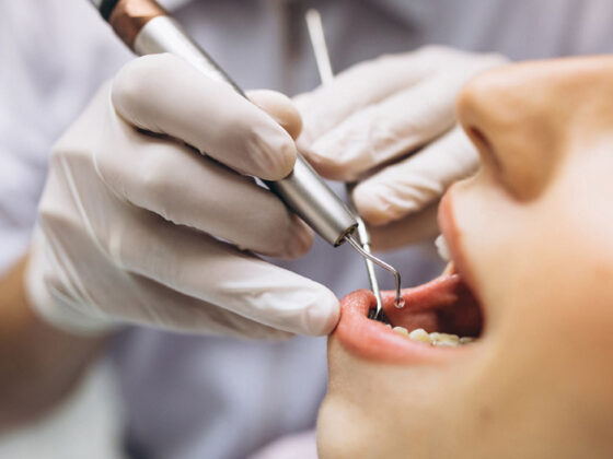 La periodontitis y el COVID19 - Clínica dental en Avilés - Suárez Rivaya
